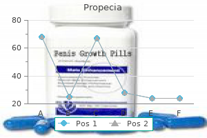 order propecia 1mg otc