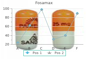 order 70mg fosamax amex