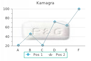 cheap kamagra online visa