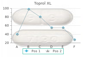 cheap toprol xl 100 mg online