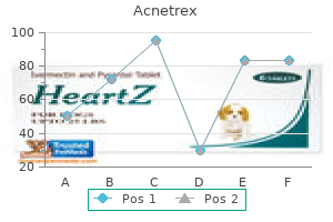 order 20mg acnetrex fast delivery