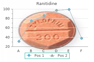 best ranitidine 300 mg