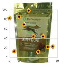 Iduronate 2-sulfatase deficiency