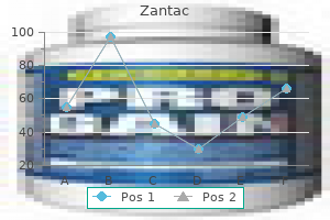 zantac 300 mg with amex